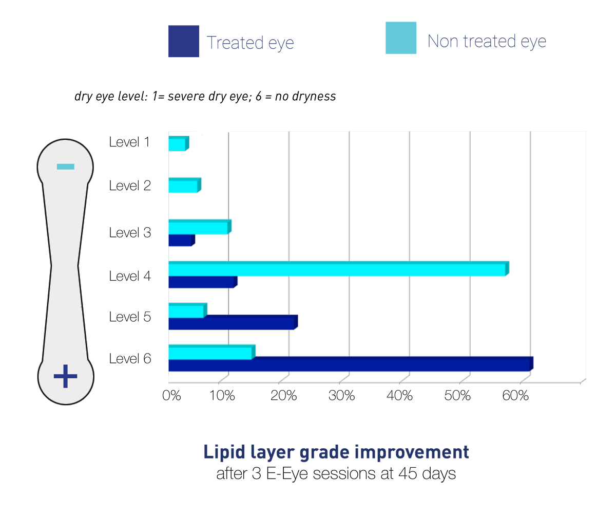 E>Eye results